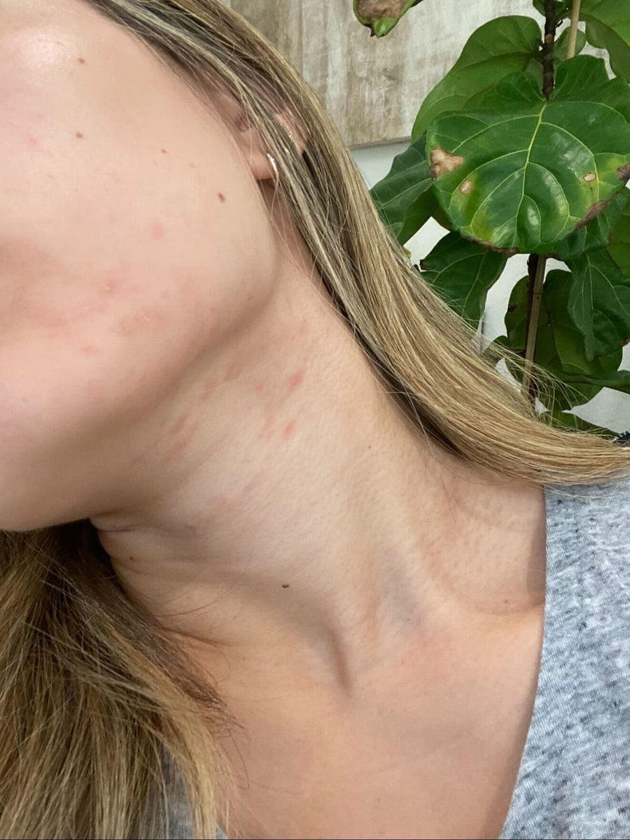 Neck and jaw, month one