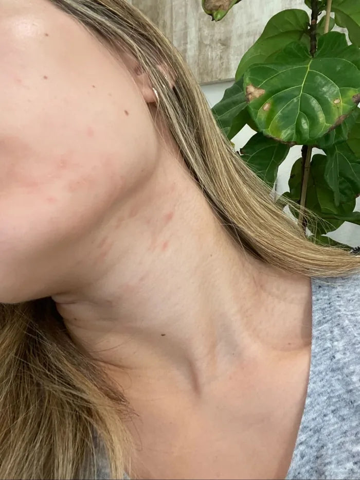 MONTH 1
